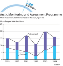 Infant mortality components in Nunavut 1999 – 2004