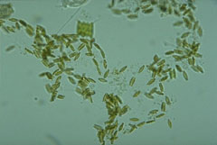 Achnanthes sp. a type of diatom