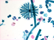 mixed desmids (chlorophytes)