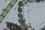 Spirogyra copulation.jpg